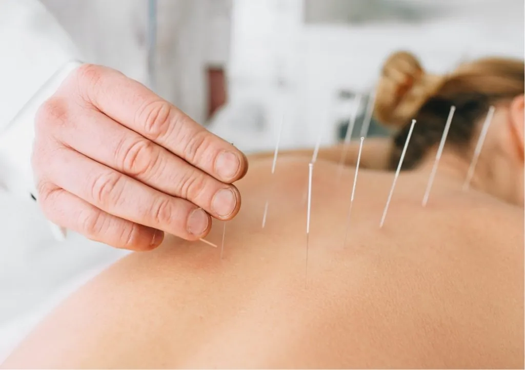 Dry Needling in Eagle-Vail